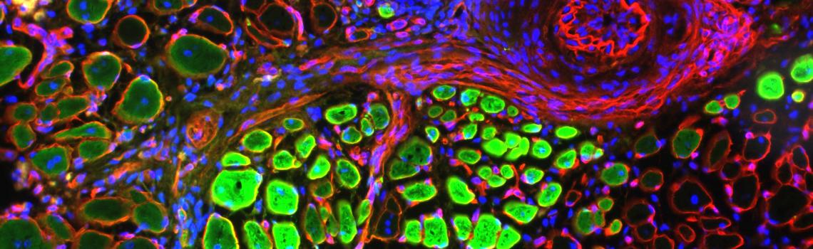 Muscle stem cells in action